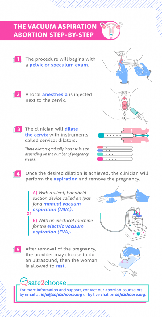 steps vacuum aspiration abortion