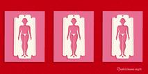 Illustration éducative montrant l'impact de la mutilation génitale féminine sur le corps.
