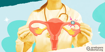 Un profesional de la salud sosteniendo un diagrama del sistema reproductor femenino, destacando la trompa de Falopio para indicar un embarazo ectopico