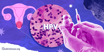 Illustration of the human papillomavirus (HPV), showing the reproductive system, a microscopic sample of affected cells, and a vaccine