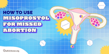 A uterus with the words Misoprostol for missed abortion