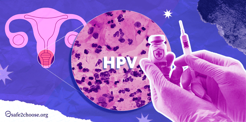 Ilustracion del virus del papiloma humano (VPH), mostrando el sistema reproductivo, una muestra microscopica de celulas afectadas y una vacuna