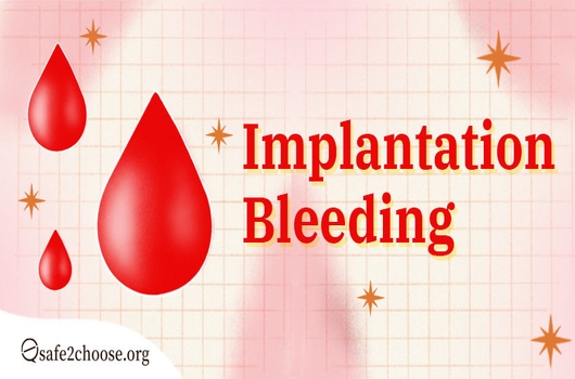 Implantation bleeding????